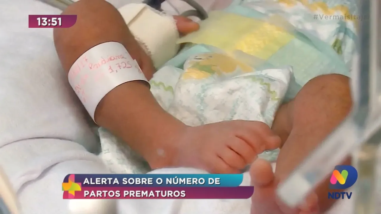 Novembro Roxo: Alerta para o número de partos prematuros