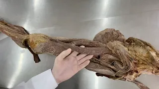 Músculos do Membro Inferior - aula prática