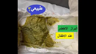 اسباب البراز الاخضر عند الاطفال 