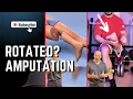 Download Lagu ANKLE becomes KNEE #amputation