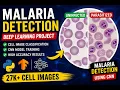Malaria Cell Classification using Vision Transformers