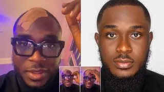 yoruba actor kiki bakare sustains head inj ry during a movie shoot says he 