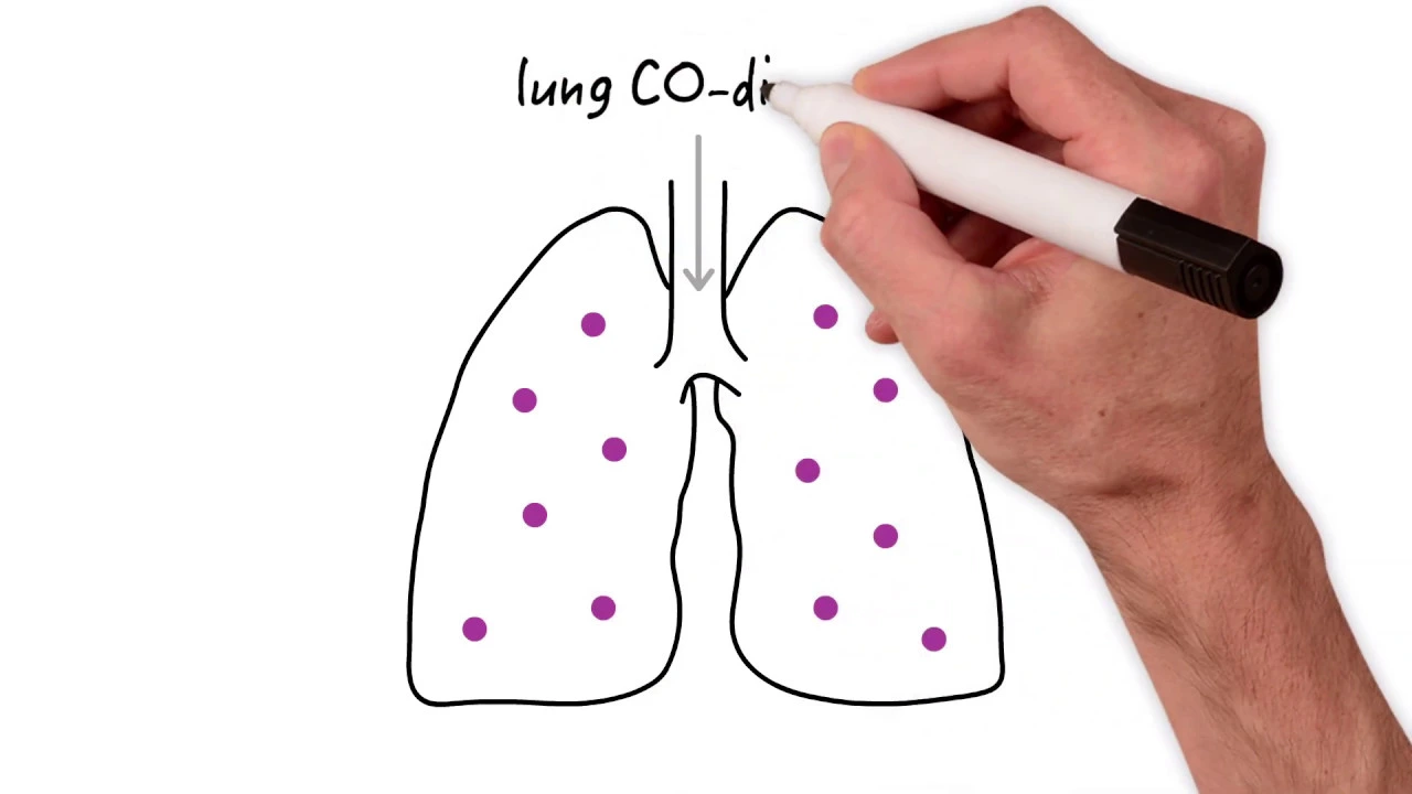 What is diffusing capacity and why is it important?
