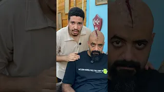 ازاي تعمل جرح سينمائي 