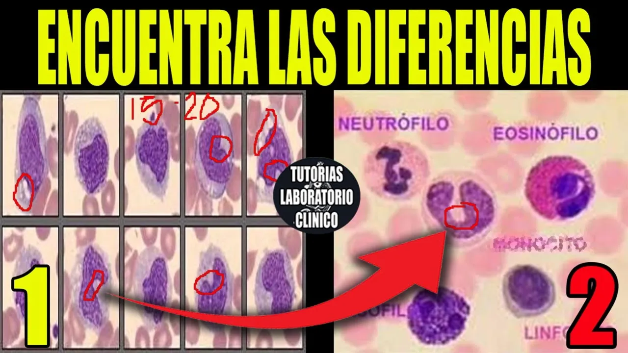 🩸Células Sanguíneas MADURAS de la Línea Blanca: Neutrófilo, Eosinófilo, Monocito, Linfocito,Basófilo