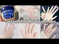 How I GOT SOFT HANDS IN just 1 DAY naturally