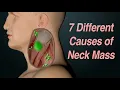 Download Lagu Adult Neck Mass: 7 Different Causes Based on Location