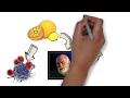Chipsa Hospital - Whiteboard animation