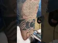 Download Lagu SCAR FREE TATTOO REMOVAL ep5 #short