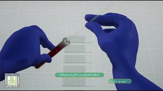 كيفية عمل فيلم الدم Blood Film 