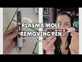 At-Home Skin Tag Remover Easy to Use Plasma Pen Review With Demo