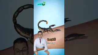 لدغة العقرب     دندنها