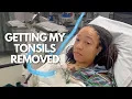 Adult Tonsillectomy Experience 10 Days of Recovery