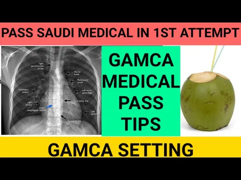 Download MP3 Saudi medical check🇸🇦 Chest xray pass☑️ Gamca medical test👍 Gamca setting🏥 GAMCA TEST FAIL REPORT😱