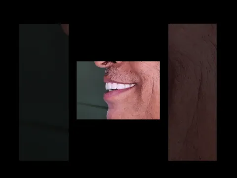 Smile design video testimonial