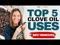 The Antioxidant Secret Health Coaches Use Clove Oil Exposed