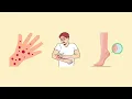 Download Lagu Dermatitis Kontak Iritan? Gampang ketauan! Gampang pencegahan!