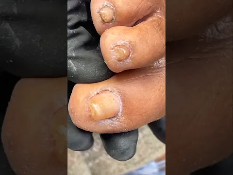 Tiramos tudo o que não presta desse dedo #unhas #unhasdecoradasamao #viral #satisfying