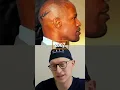 Jamie Foxx Hair Transplants