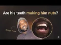 Kanye West s 850 000 Titanium Teeth Crazy or Actually Making Him Healthier
