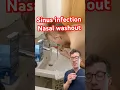 Download Lagu Doctor explains SINUS WASHOUT #shorts
