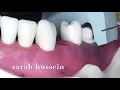 36-pfm assessment