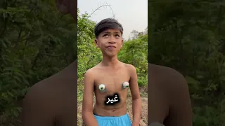 كانت تحاول فقط قطع غصن من الشجرة لكن الأمور لم تسر كما توقعت 