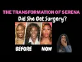 The Transformation of Serena Williams Skin Bleaching Cosmetic Surgery Weight Loss Drugs