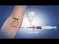 The Sequestration Syringe Blood Culture Collection Device from C-Quest Medical