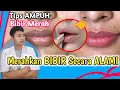Download Lagu Cara Cepat Merahkan BIBIR Secara ALAMI | Cara Ampuh Mencerahkan BIBIR HITAM || dr. Andi Septiawan