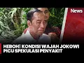 Download Lagu Kondisi Jokowi Picu Spekulasi Penyakit, Ajudan: Bapak Sehat, Hanya Alergi | iNews Pagi | 28/6