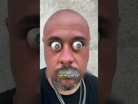 وشم مؤقت لقط أصلع... النتيجة صادمة! 😲