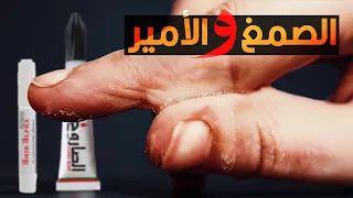 ليه الأمير والصمغ بيلزقوا في الصوابع بالشكل البشع ده 