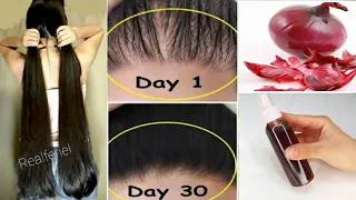 Faites pousser vos cheveux plus rapidement  ! Testez la recette !!!