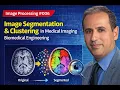 Image Processing - Image Segmentation Clustering in Medical Imaging Biomedical Engineering