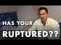 How do you know when your breast implant is ruptured