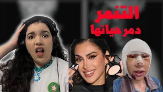 قصة هدى قطان وبوجون مع وهم التجميل                                                         دندنها