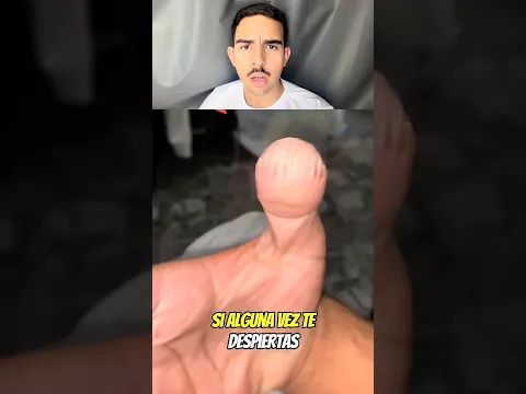 ¡TEN CUIDADO SI TU MANO SE PUSO ASÍ! 😳😱 ib: @secretoscuriososs