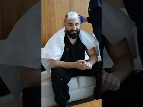Saç ekiminin üçüncü günü 👉 @NowHairTime #2026 #youtubeshorts #sacekimi #hairtransplant #turkey