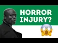 What Happened to Seal s Face