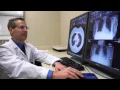 Pulmonary and Respiratory Medicine - Glenn Van Otteren MD