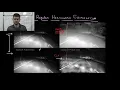 RO-1 0X046 Regular Histogram Equalization vs CLAHE Example