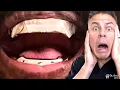 Did Kanye West REALLY Spend 850 000 To Replace His Teeth