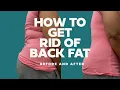 How To Get Rid Of Back Fat