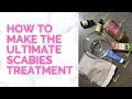 How To Make The Ultimate Scabies Treatment At Home That Works