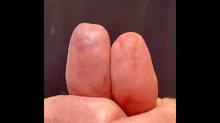 10 Aug 2023  Magic restoration of tumb