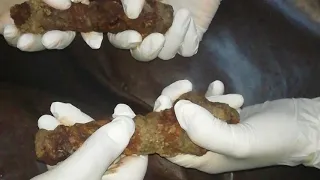 سحر القط الأسود و سحر المسامير 