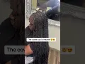 Alopecia braids