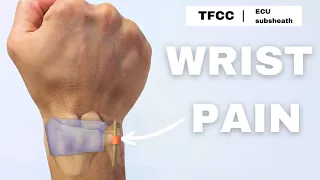 Wrist pain TFCC ECU sub-sheath rehab