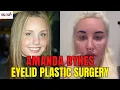 Amanda Bynes Eyelid Plastic Surgery